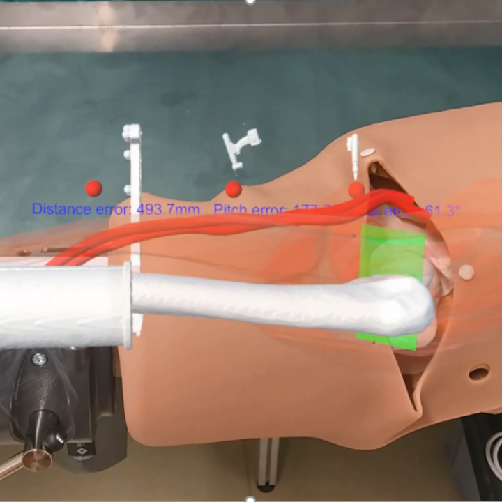 With the help of AR, the surgeon is shown how to perform the surgical procedure on an artificial femur.