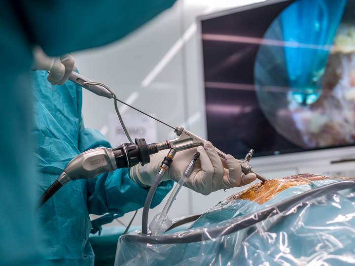 Close-up of an endoscope in operation.